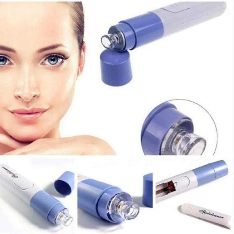 Blackhead Remover